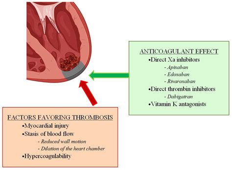 left ventricular thrombus patient education